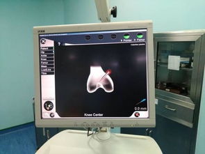 計算機輔助導航技術與移動應用在膝關節置換中的開發與運營體會